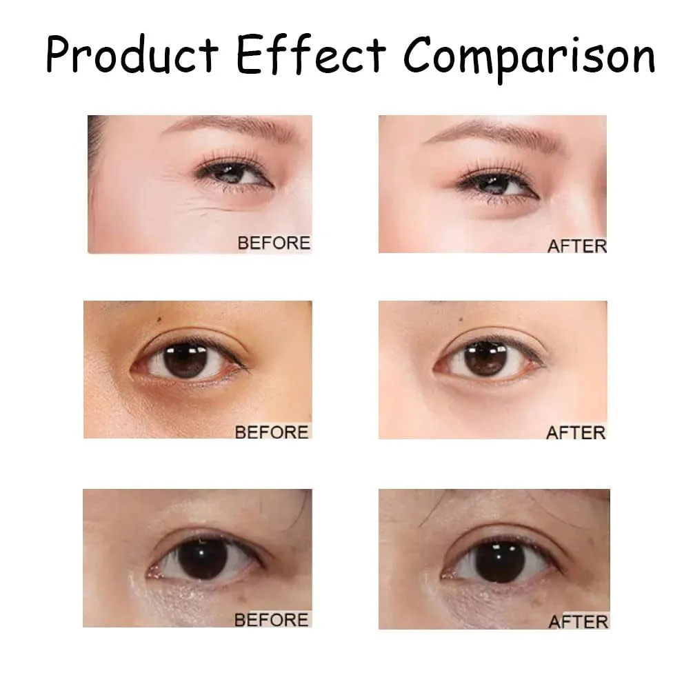 Beautyfeb Lutein Anti-Wrinkle Essence Oil,Lutein Eye Wrinkle Essence Oil,Vc Lutein Essential Oil,Vitamin C Lutein Eye Essence Oil,Lutein Rollerball Essence (2PCS)